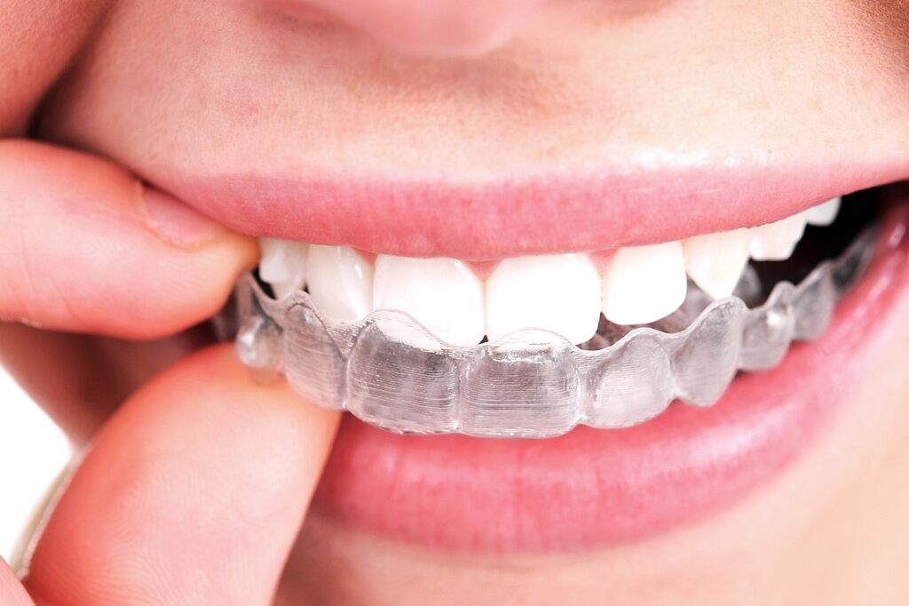 Invisalign